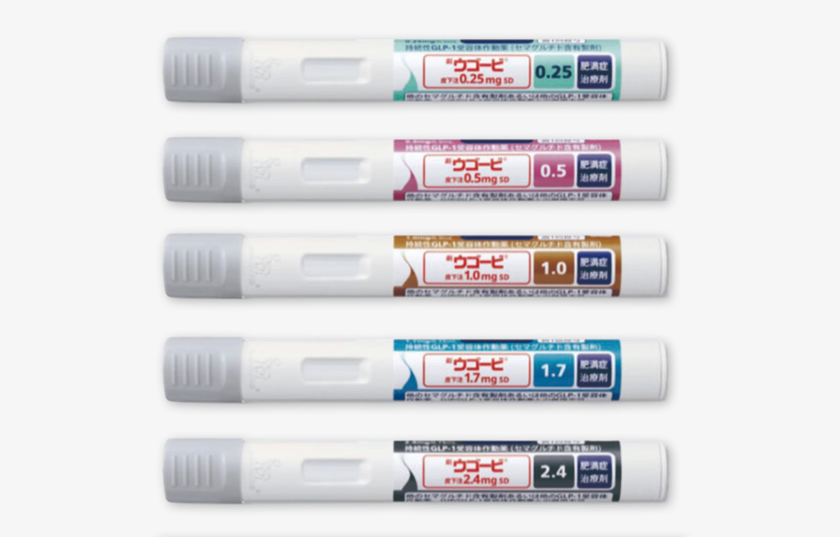 ウゴービとは？